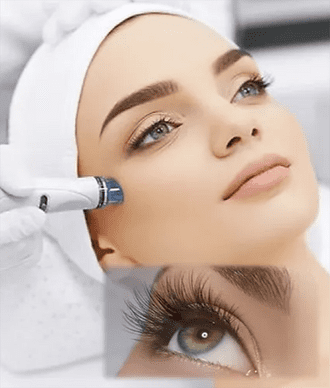 Microneedling